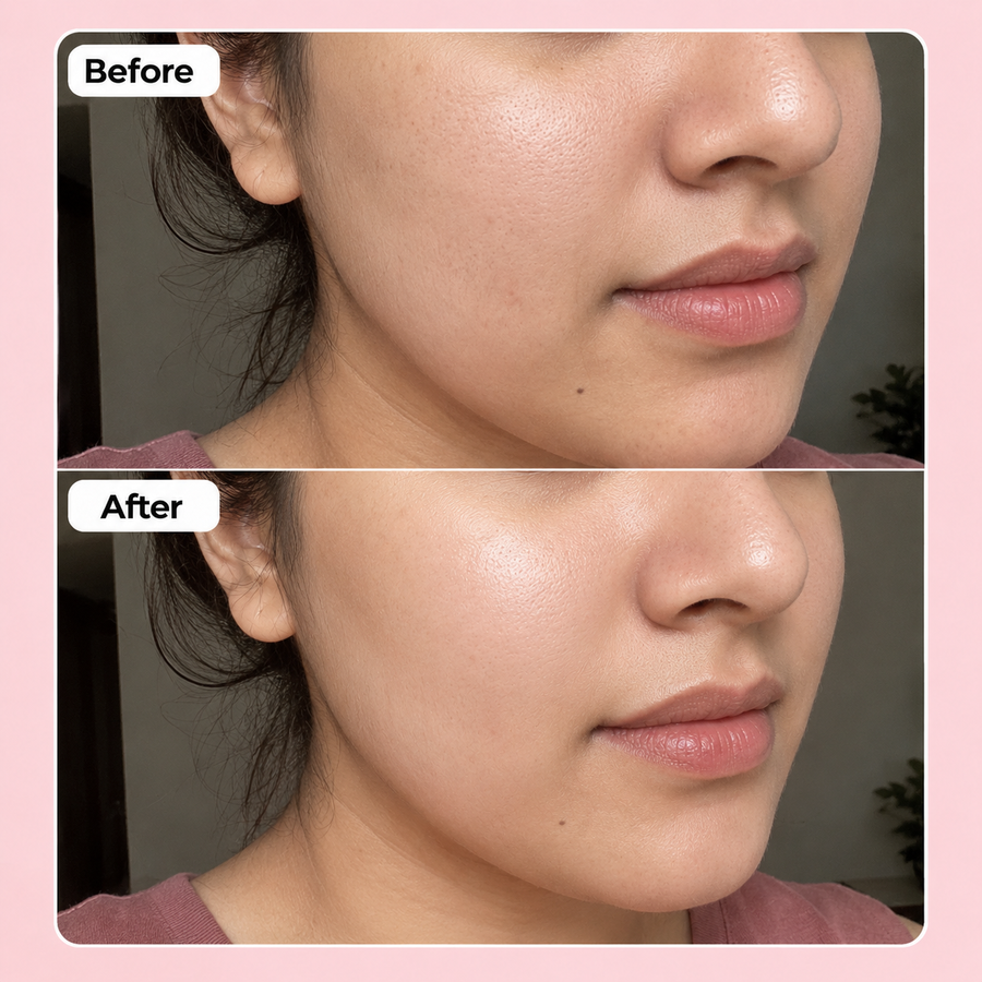 Hydration Boost Deal | Hyaluronic Acid Serum Deal results