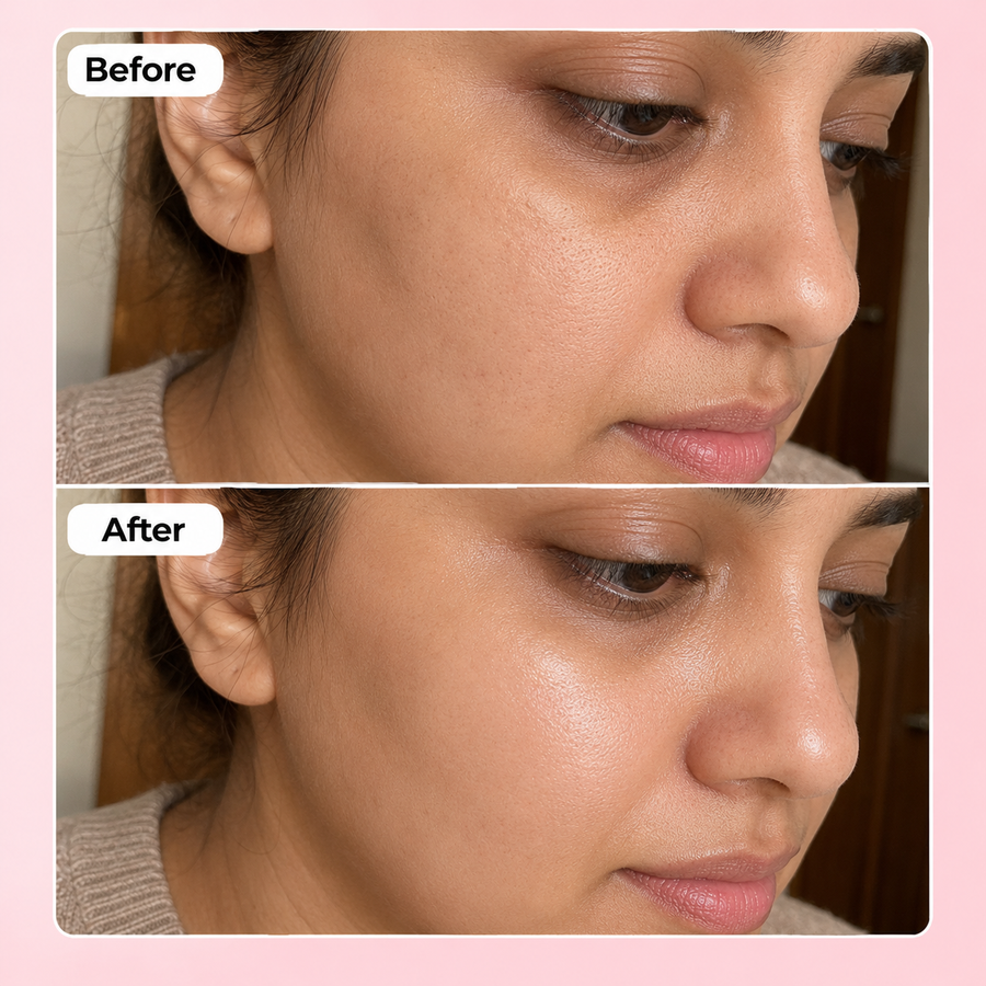 Hyaluronic Acid Serum | Hydrating Serum results