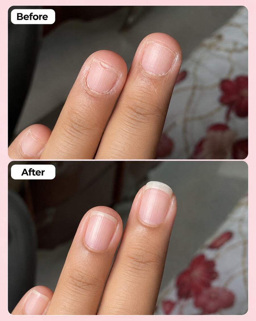 Nail Growth Serum | Nail Strengthening Serum results