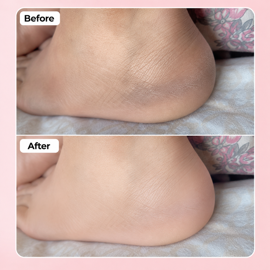 Intimate Care Deal results