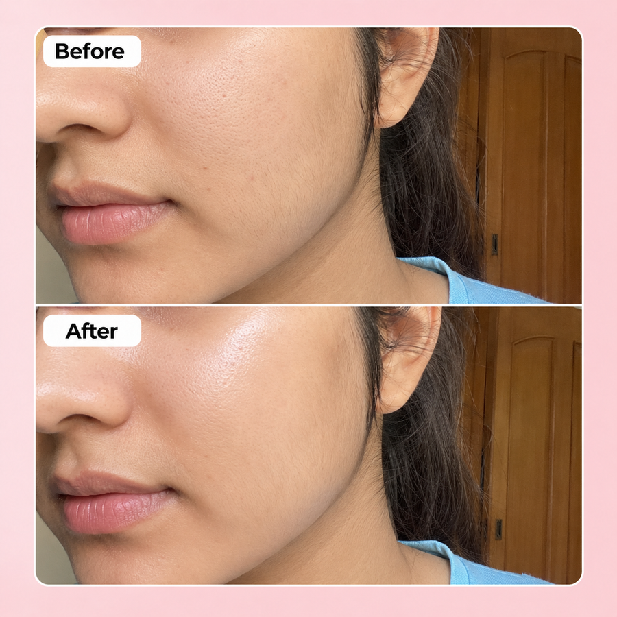 Hydration Boost Deal | Hyaluronic Acid Serum Deal results