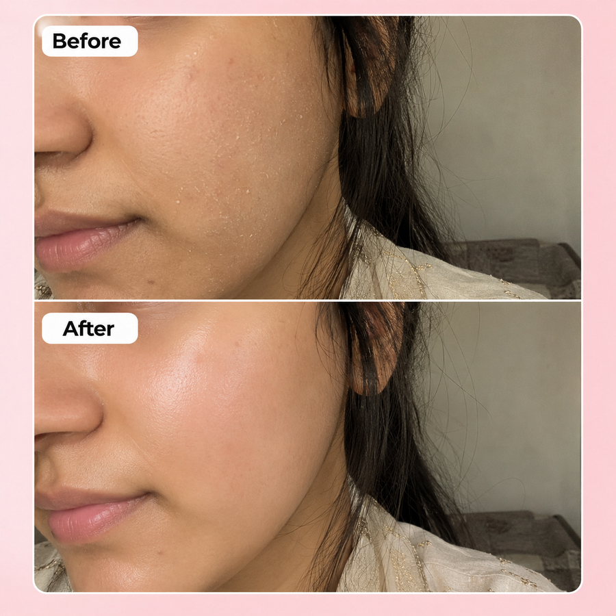 Hydration Boost Deal | Hyaluronic Acid Serum Deal results