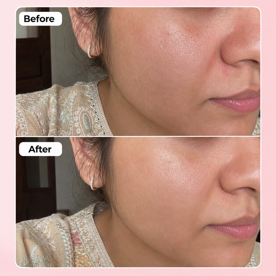 Soothing Lotion | Face Shiner results