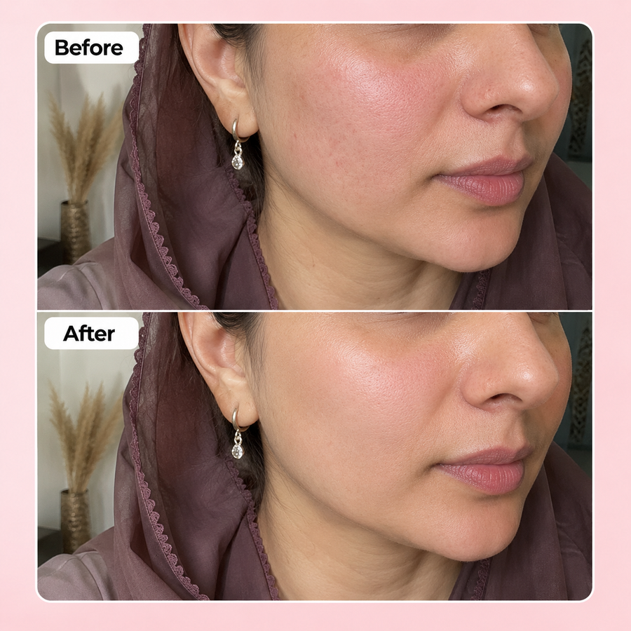 Soothing Lotion | Face Shiner results