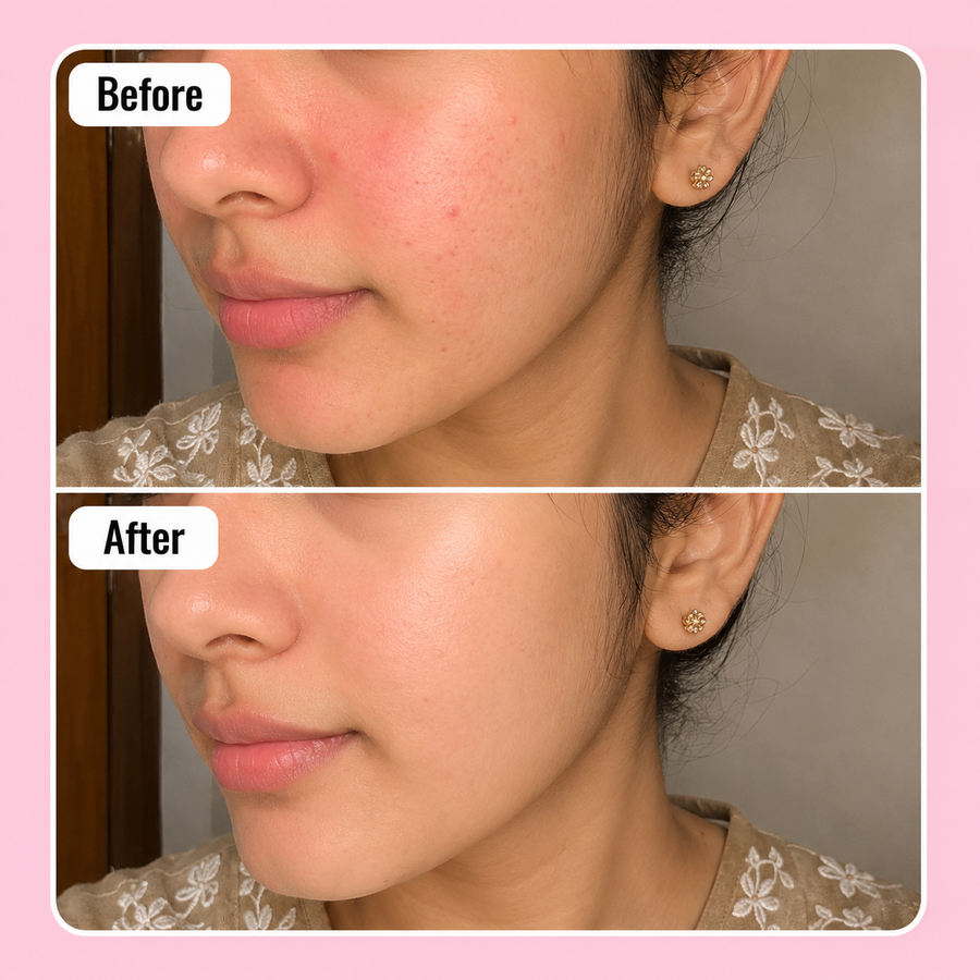 Soothing Lotion | Face Shiner results