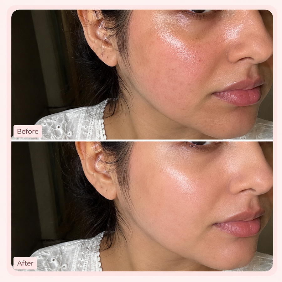 Hydration Boost Deal | Hyaluronic Acid Serum Deal results