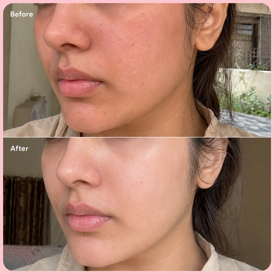 Sunblock SPF 60 | No White Cast results