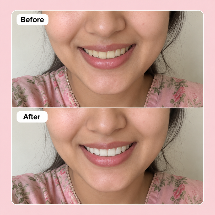 WOW WHITE Teeth Whitening Powder | Activated Charcoal Powder results