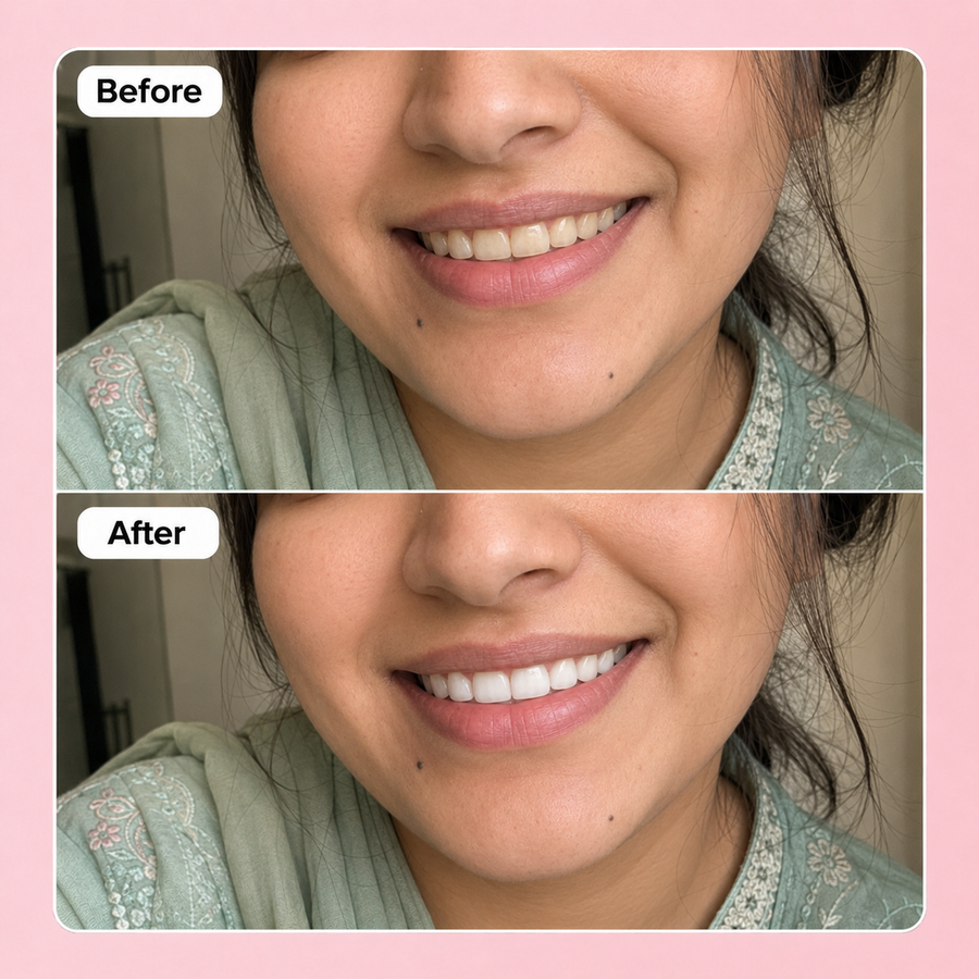 WOW WHITE Teeth Whitening Powder | Activated Charcoal Powder results
