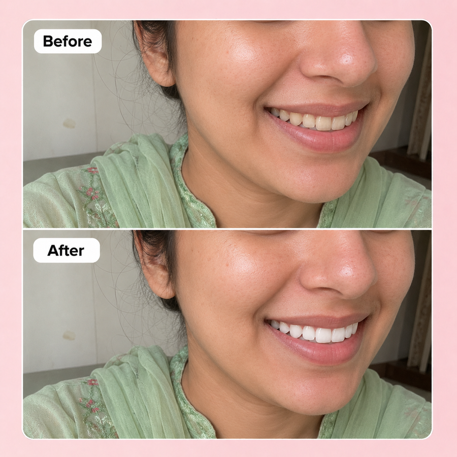 WOW WHITE Teeth Whitening Powder | Activated Charcoal Powder results