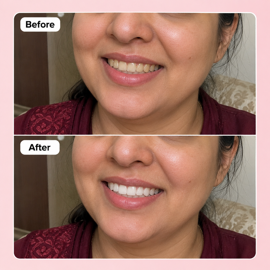 WOW WHITE Teeth Whitening Powder | Activated Charcoal Powder results