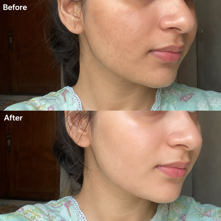 Wow Ubtan Powder | Brightening Mask results