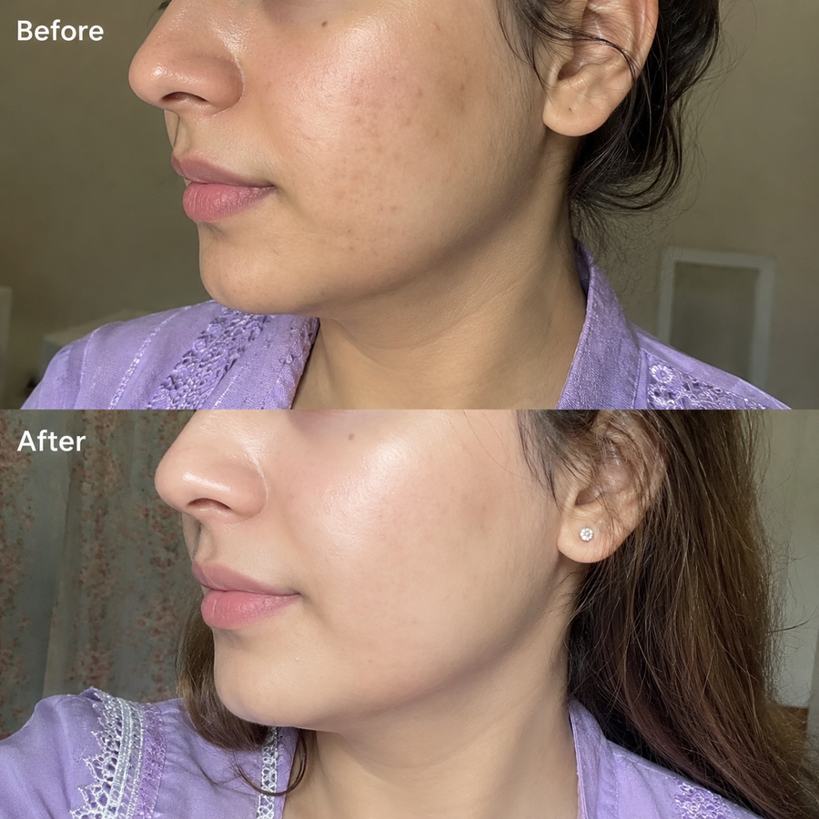 Wow Ubtan Powder | Brightening Mask results