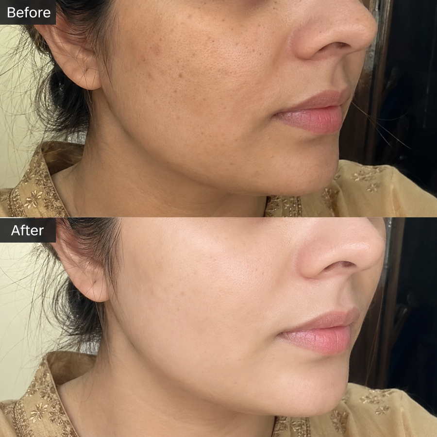 Wow Ubtan Powder | Brightening Mask results