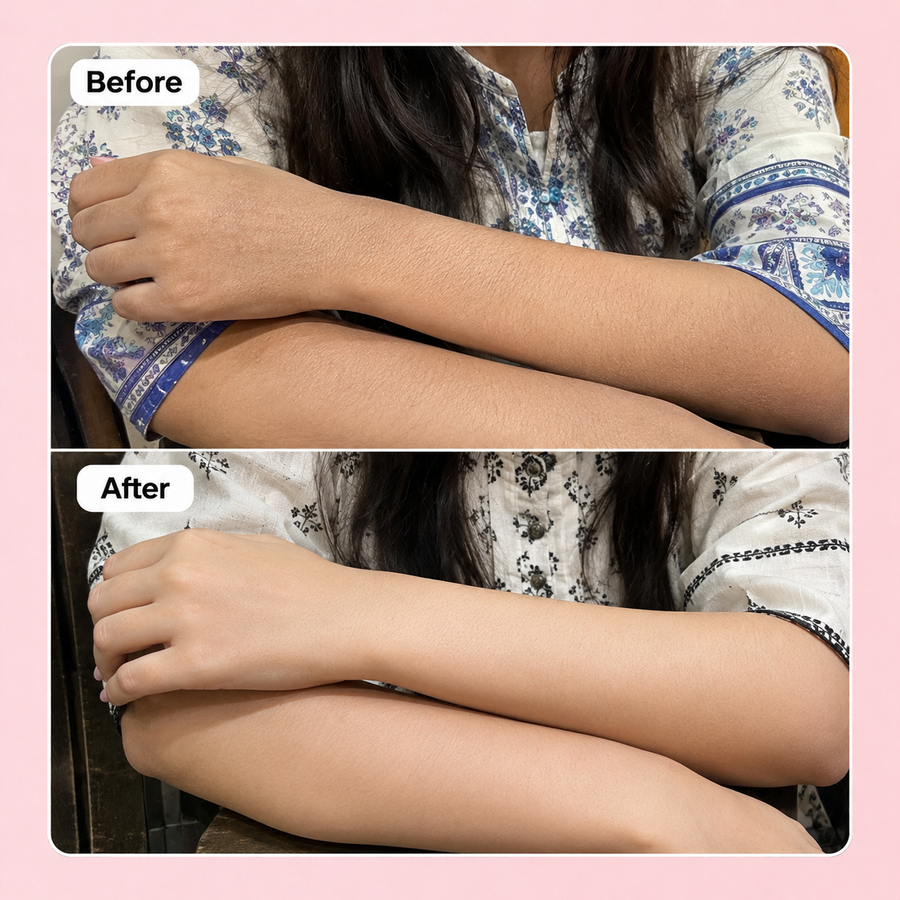 Wow Sugar Scrub | 2% Glycolic Acid results