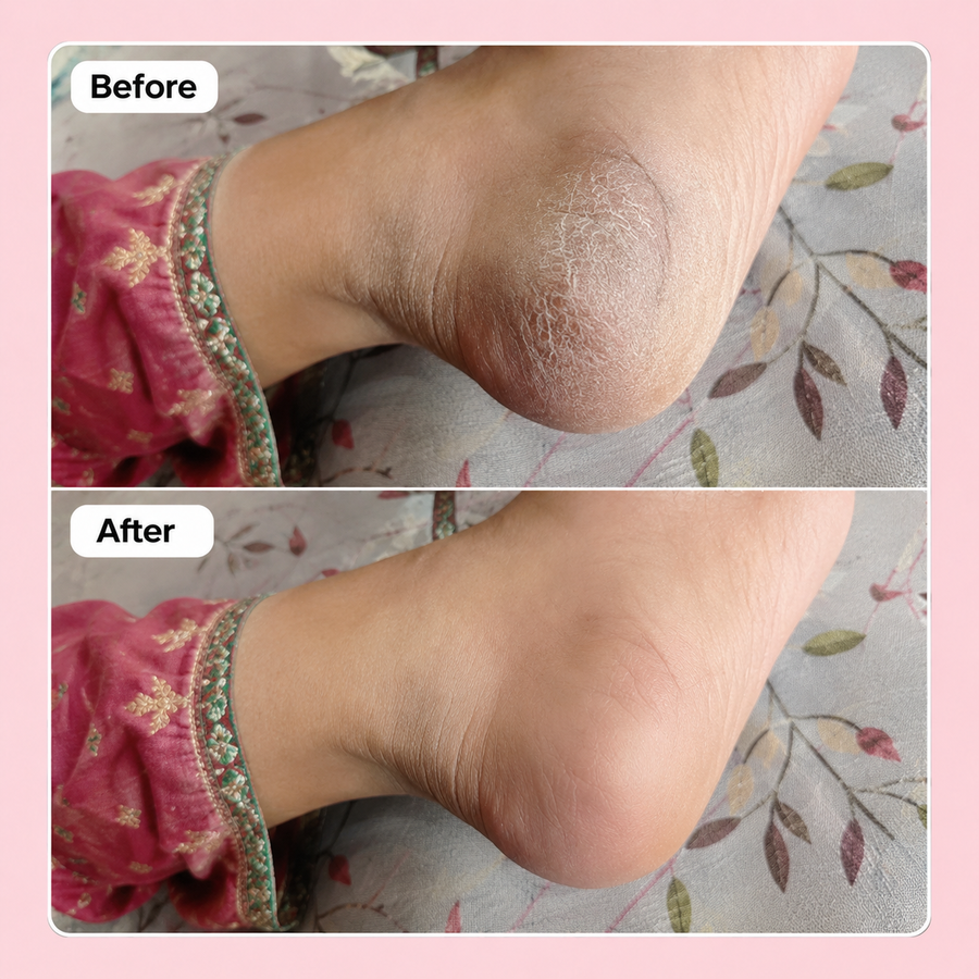 Wow Sugar Scrub | 2% Glycolic Acid results