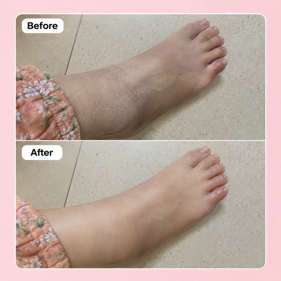 Wow Sugar Scrub | 2% Glycolic Acid results