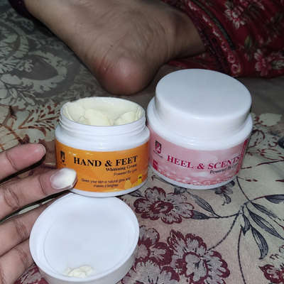 Customer review photo for HEELS and SCENTS Cream - Cracked Heel & Foot Odor Remover Cream