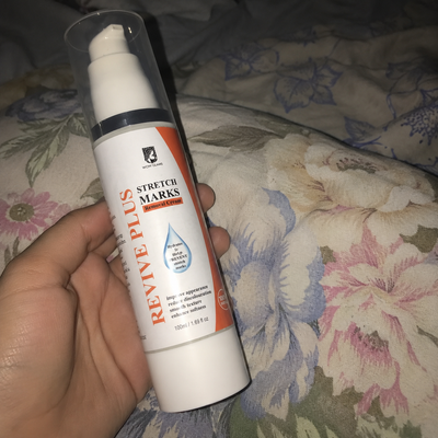 Customer review photo for REVIVE Plus Stretch Mark Cream
