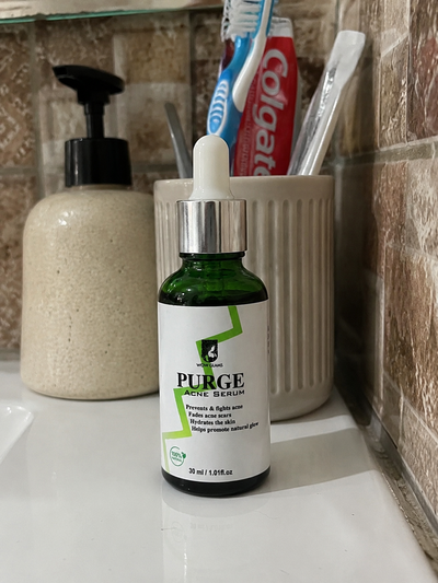 Customer review photo for PURGE Acne Care Serum