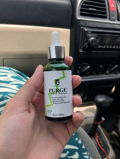 Customer review photo for PURGE Acne Care Serum