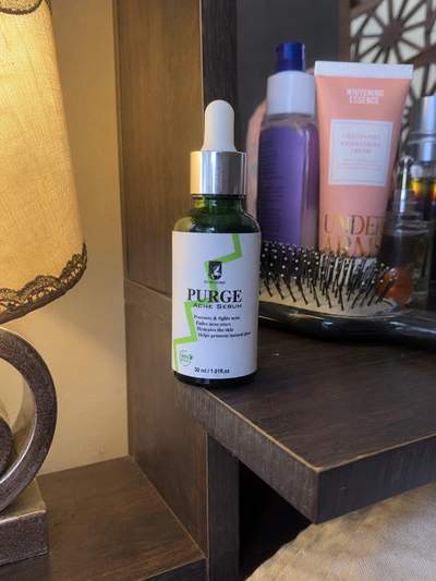 Customer review photo for PURGE Acne Care Serum