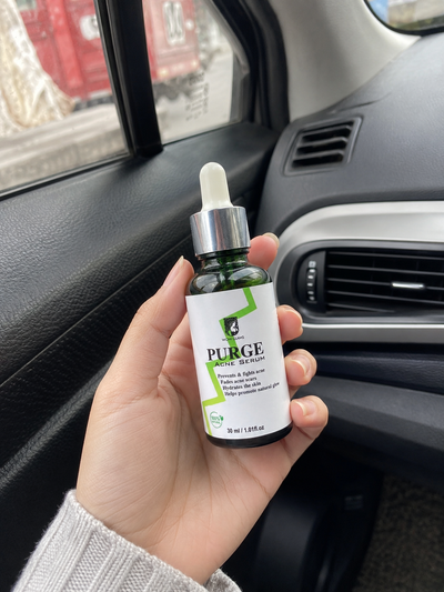 Customer review photo for PURGE Acne Care Serum
